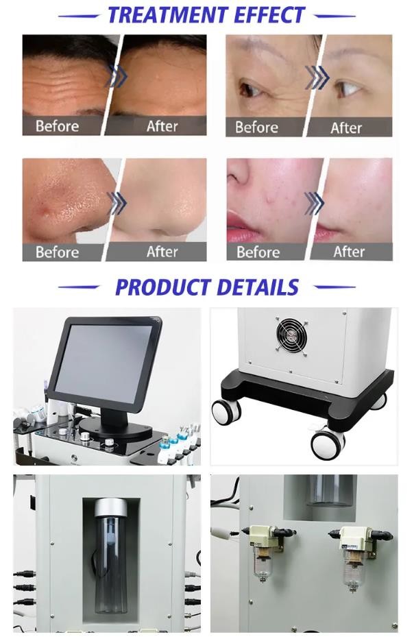 Wrinkle Remover Hydrafacial Equipment With 2 Photon Light Handles