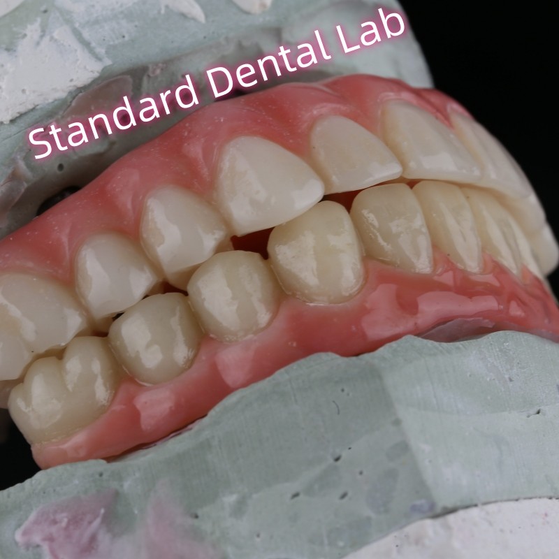 Porcelain Zirconia Dental Implant Bridge Professional High Esthetics With Pink Gum