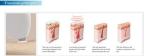 10 million shots warranty 800W 808nm diode laser permanent laser hair removal /