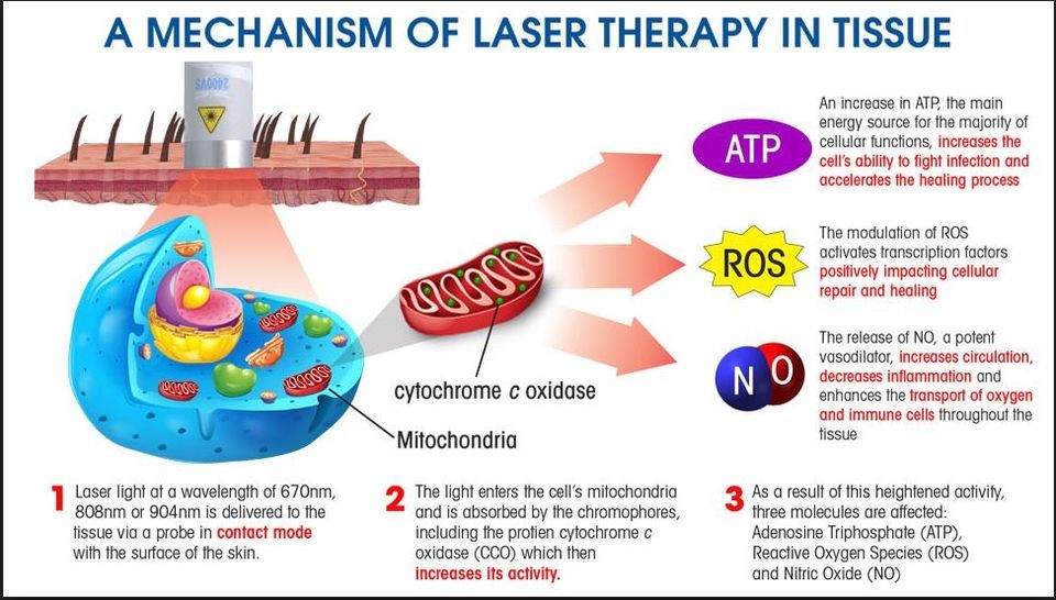 Portable Class 4 Laser Therapy Machine 980nm 810nm