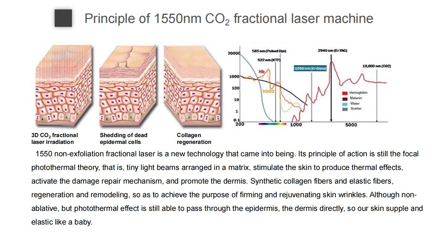Skin Resurfacing Er Yag Laser Machine Super Penetration Wrinkle Removal Device