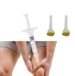 Knee Osteoarthritis Mesotherapy Treatment Non Cross Linked Hyaluronic Acid