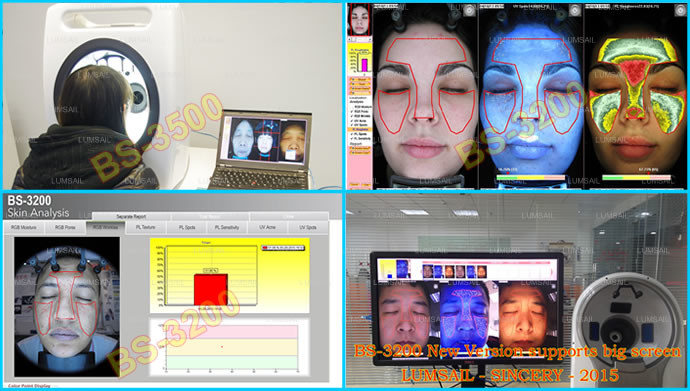 Auto - Analysis Skin Analysis Machine Lightweight With UV Voice System