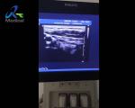 IE33 Ultrasound Machine Repair Small Parts Probe Image Loss