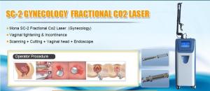 China USA RF tube Newest vaginal tighten RF tube CO2 fractional wholesale