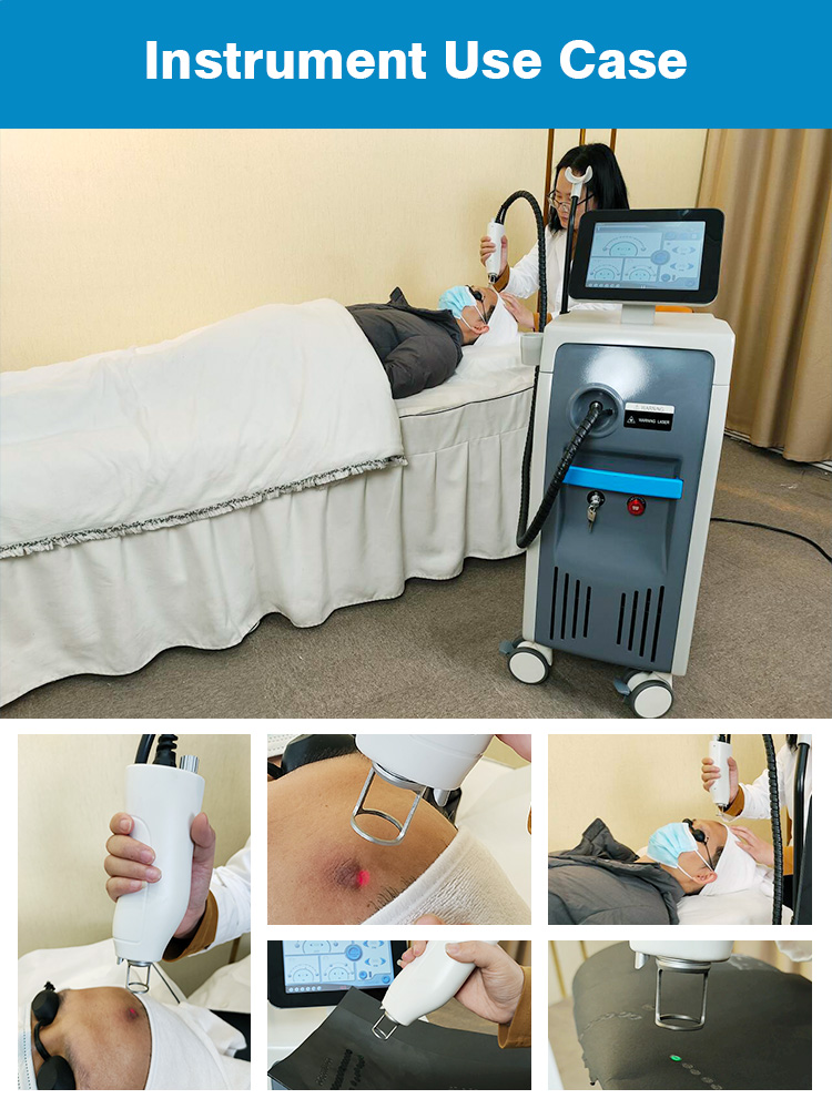 100J/Cm2 Fiber Laser Alexandrite Laser Machine For Blood Vessels Removal