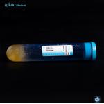 Platelet Rich Plasma Kits 20ml For Cosmetics Orthopedics