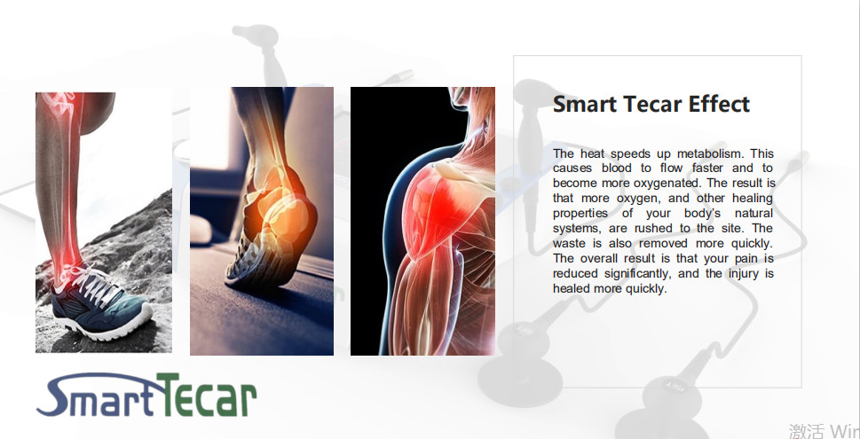 Deep Heating Massage Diathermic Therapy Tecar Therapy Machine For Body Pain And Sport Injury