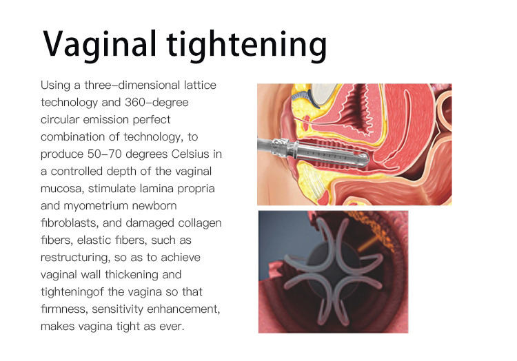 30W CO2 Fractional Laser Machine 10600nm female intimate areal Tightening Equipment