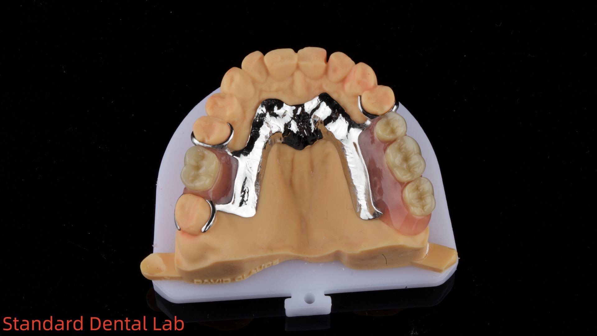 CorCr Metal Partial Denture High Light Beryllium Free Ivoclar Scheftner Comfortable Metal Framewrok