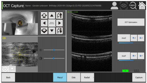 PC Inside Oct Scan Machine 75 Lbs For Fundus Diseases Glaucoma