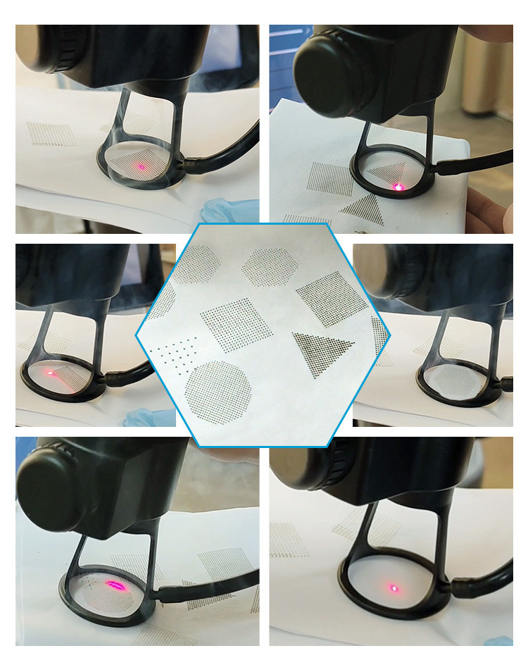 CO2 Fractional Laser Machine With Two Years Gurantee Time From Software Department