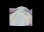 Durable Porcelain Fused To Metal Dental Crown PFM Crown For Restoration