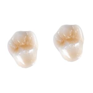 China All-Ceramic FDA 3014652903 Zirconia Dental Crown Veneer Inlay Onlay wholesale
