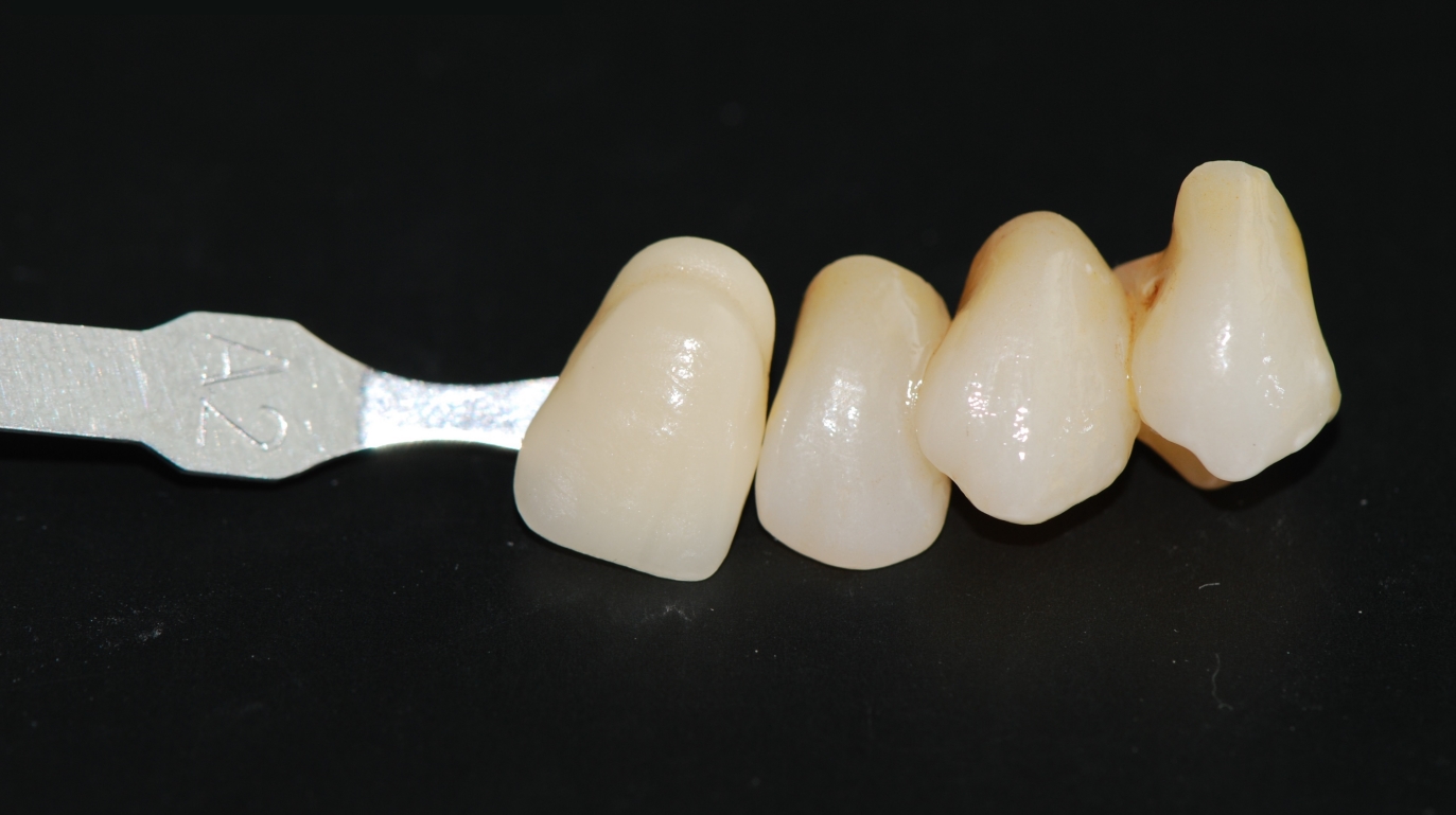 1100Mpa 37% Translucent Dental Zirconia Blocks 3.1g/cm3 For Dental Crowns