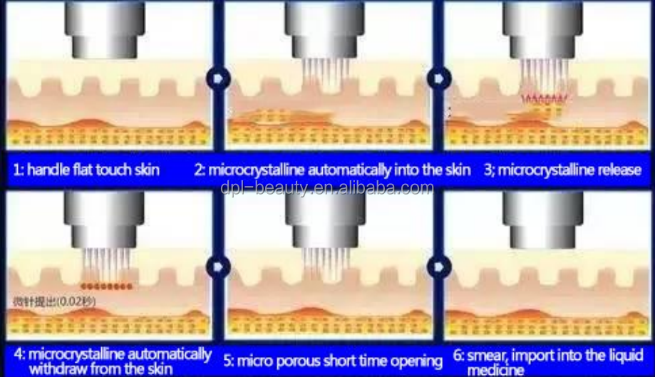 Golden Nano Fractional RF Microneedling Devices For Home Acne Removal