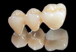 China All Ceramic Zirconia Dental Crown wholesale