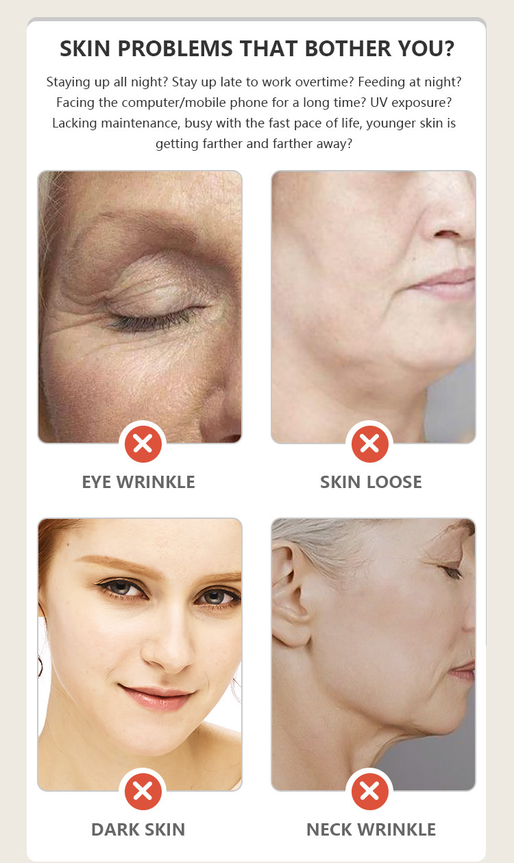 4 Gears PSE Eye Wrinkle Remover Rejuvenating Red Light Therapy