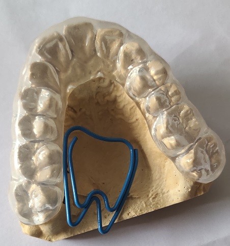Transparent Night Guard For Bruxism