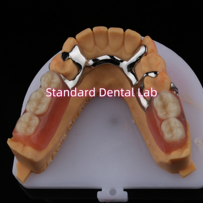Alloy Metal Partial Denture Framework 3 Shape Exocad Laser Printing Lower Cast Partial Finish