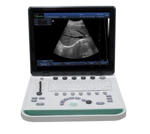 China PC based 3D Ultrasound Machine SS-9 Laptop Ultrasound scanner wholesale