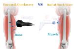 Focal Focus Shockwave Soft Shock Wave Eswt Physiotherapy Device