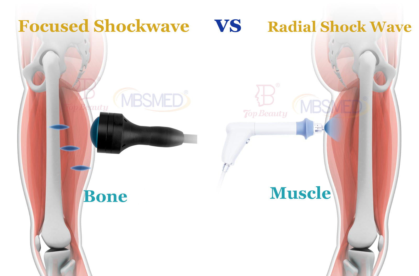Focus Shockwave Softwave Shock Therapy Tissue Regeneration Machine