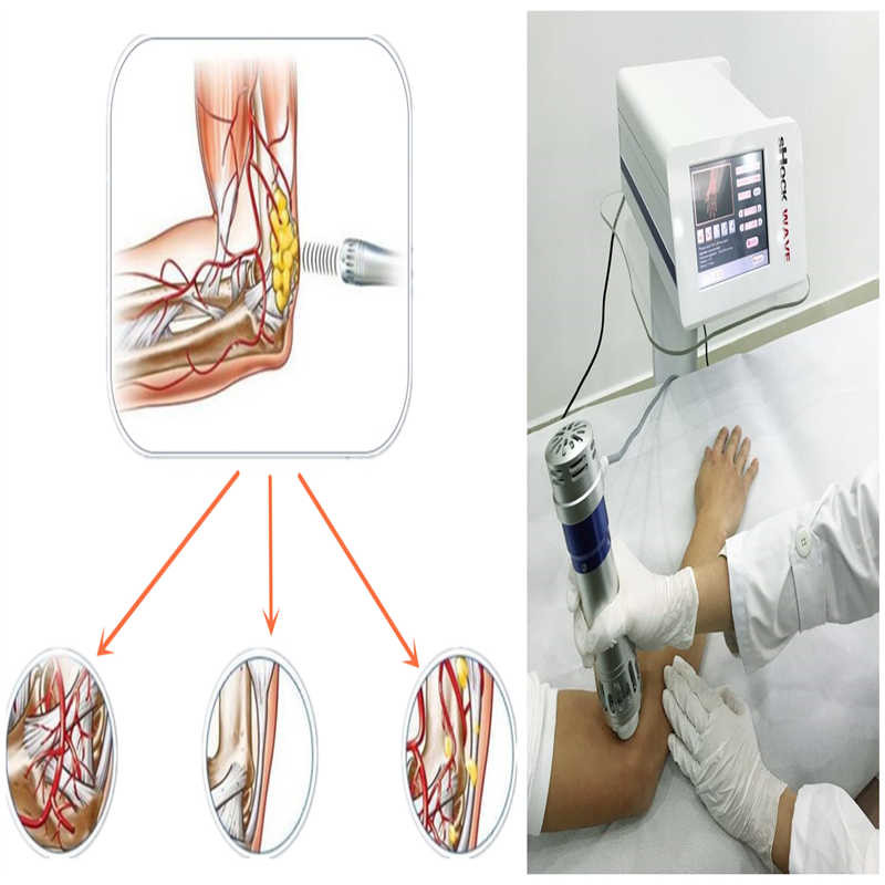 ESWT Full Body Therapy Machine, Pain Removal Machine With 5 Transmitters
