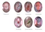 High Definition Women Self-Examination Endoscope AV ( video ) Signal Digital