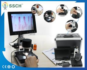 China Portable Video Microcirculation Microscope Nailfold Capillary with CE wholesale