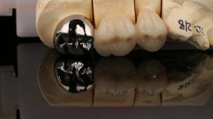 China Vita Porcelian Full Metal Crown With Post Core 3 Years Guarantee from Dental Lab wholesale