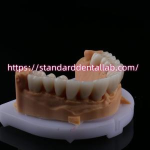 China FDA High Esthetics Dental Zirconia Bridge With Layered Porcelain zirconia dental crown China Dental Lab wholesale