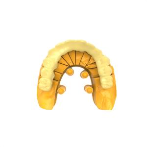 China Flexible Clear Permanent Crown Resin for Dental Restorations wholesale