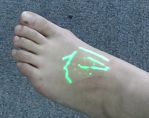 Vascular Transilluminator Vein Finder Infrared Vein Locator Device To Find