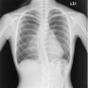 China KND-A / F Medical X Ray Films wholesale