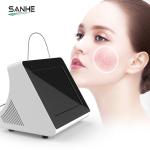 980nm Medical Diode Laser Spider Vein Removal Vascular Removal 980 nm laser