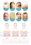 Vacuum Fractional Rf Microneedle Machine For Acne Scars