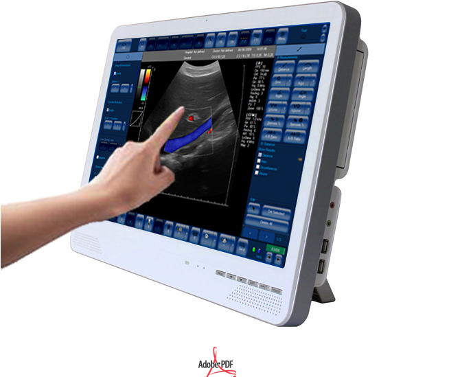 Touch screen color doppler,Protable color doppler,22" color doppler with convet probe SGC6