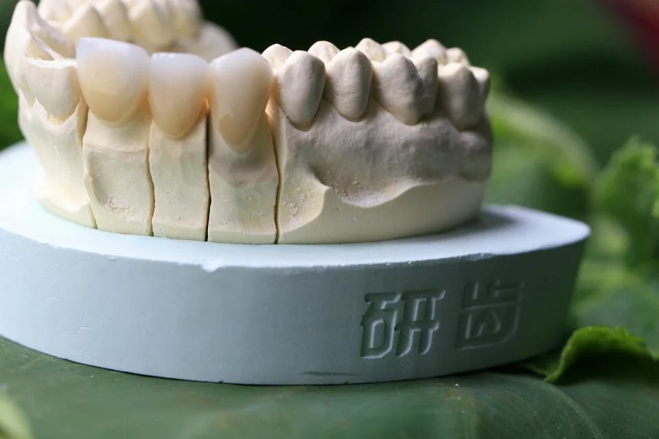 Aesthethics Glass Ceramic EMAX Posterior Crowns For Molars