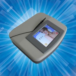 China 30MHz Spider Vein Removal Machine / Laser Vein Removal / Vascular Removal wholesale
