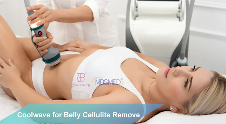 Ice Microwave Fat Reduction Onda Coolwave Machine For Skin Tightening Professional Onda Sculpting Weight Loss Cellulite Removal