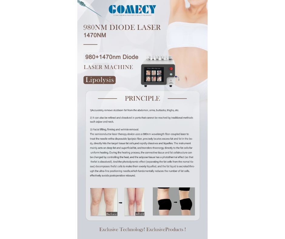 Optical Fiber Face Lifting Skin Tightening Facial 980nm 1470nm Facelift Laser Endolaser Machine