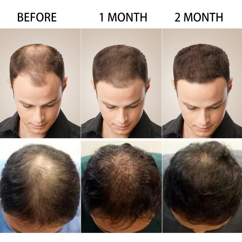 Customization Hair Growth Treatment Serum for Black Women Private Label