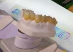 CAD CAM Design PFM Dental Crown Laboratory 3D Printer Dental Crowns
