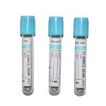 Phlebotomy Anticoagulant Vacuum Blood Sample Collection Tube Vials