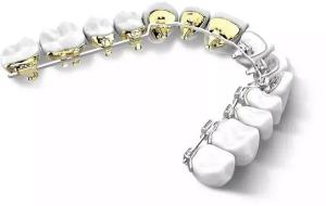 China Dental BracesFixed Orthodontic Appliances Side Back Invisible Lingual Braces Aesthetic Natural wholesale