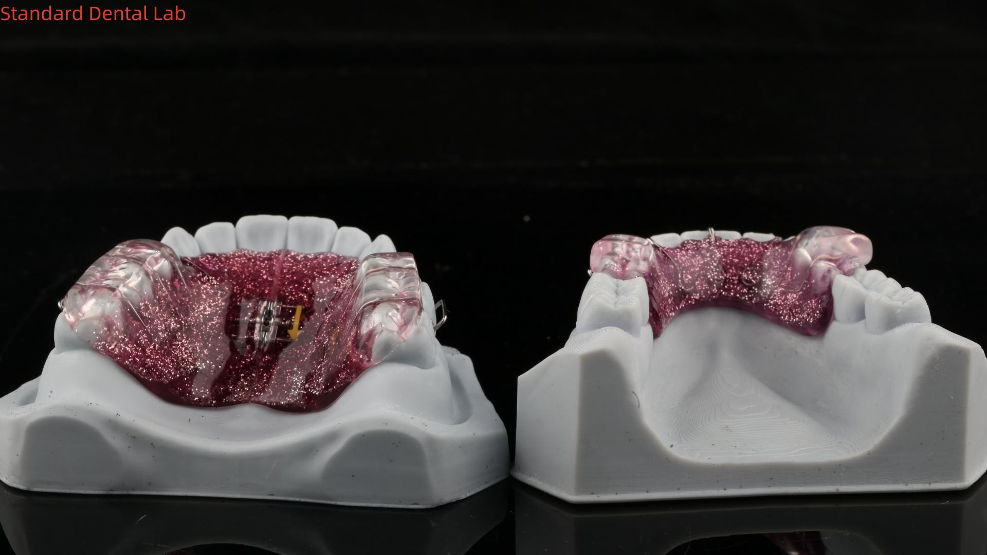 Teeth Expansion And Distalization Adjusting Expander In Mouth Orthodontist Palate Expander