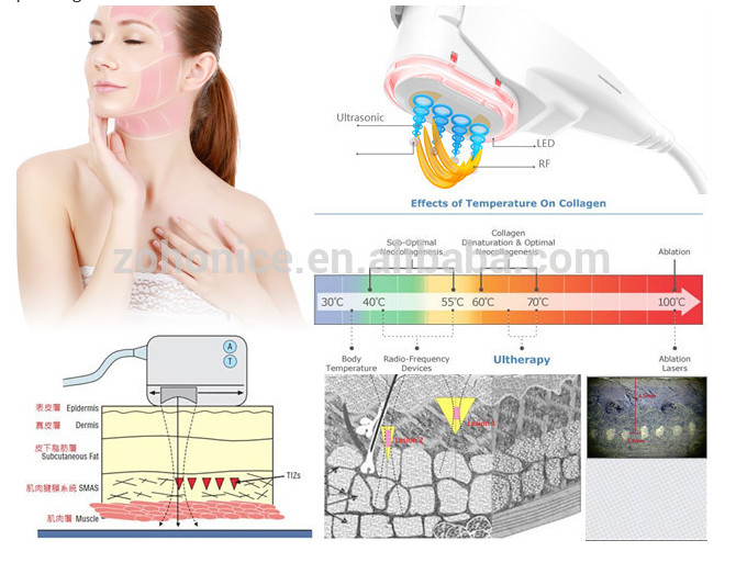 Mini Supersonic 3D HIFU Machine 3MHZ Effective Non Invasive For Skin Tightening