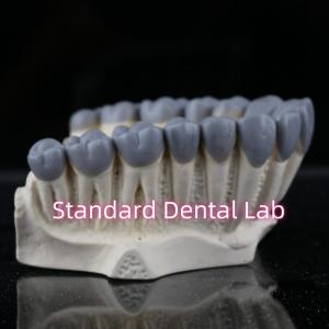 China SDL Dental Lab Digital Diagnostic Wax Ups Crown Bridge wholesale
