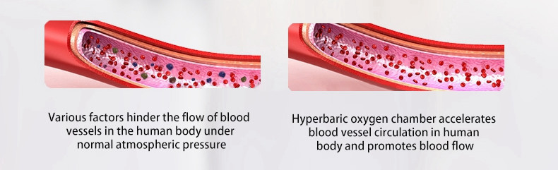 Strengthen Immunity Hyperbaric Hard Chamber WEIZI 2000mm High Efficiency